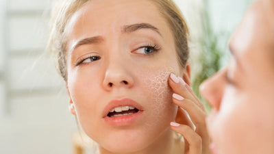 Hard Water and Your Skin: The Hidden Cause of Dryness, Irritation, and Dull Hair